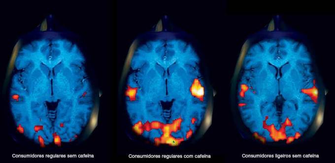 cerebro3fases_Legendas